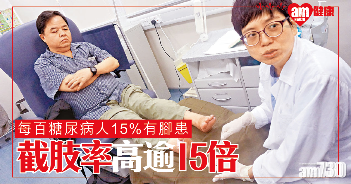 每百糖尿病人15至25人有腳患 截肢率高逾15倍
