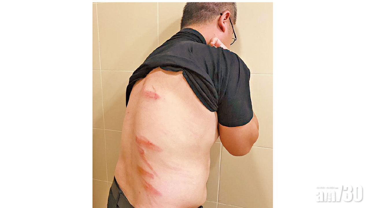 梁金成遇襲 著不要搞事 警列「聲稱襲擊」案