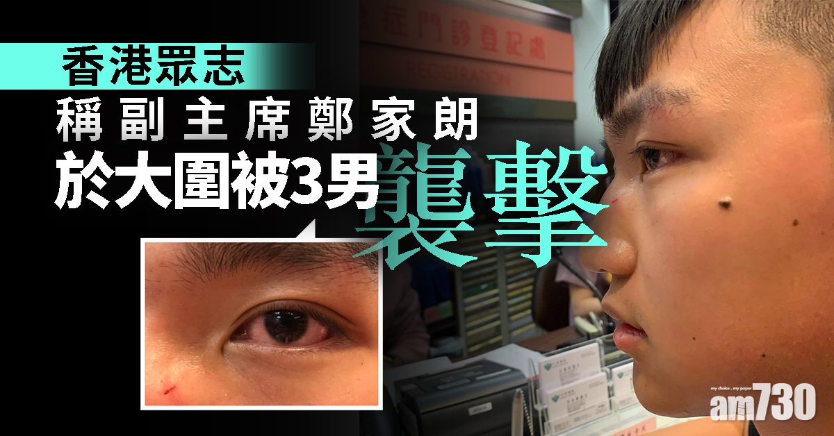 香港眾志：副主席鄭家朗在大圍被3男襲擊