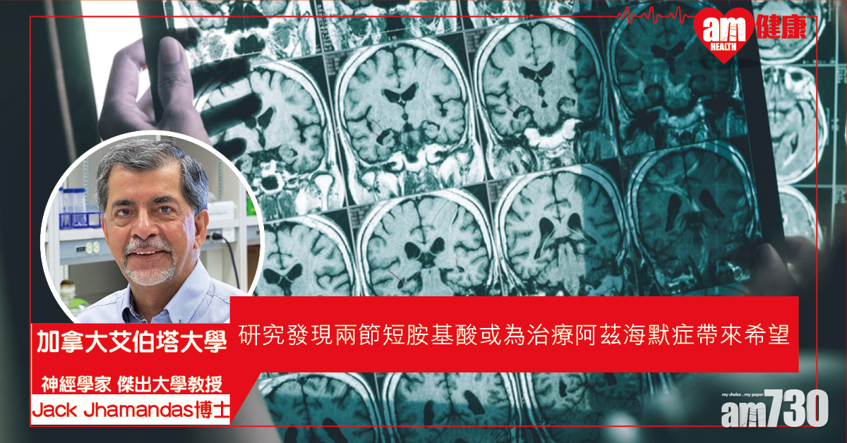 【根治腦疾病】研究發現一種新化合物 或可治療阿茲海默症