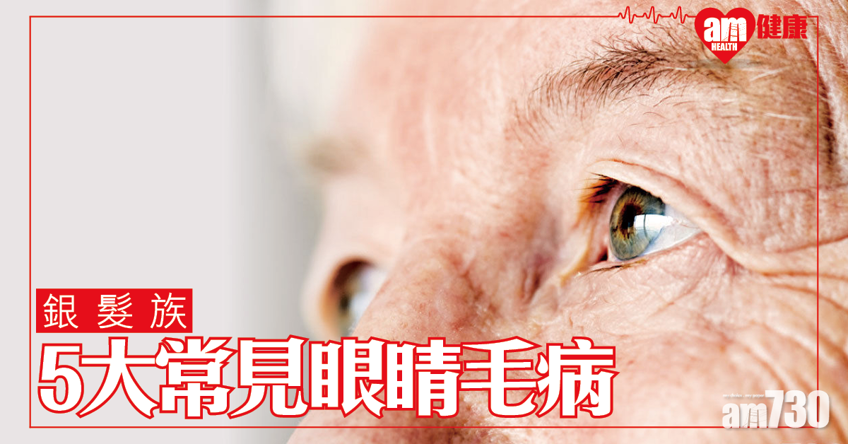 銀髮族5大常見眼睛毛病