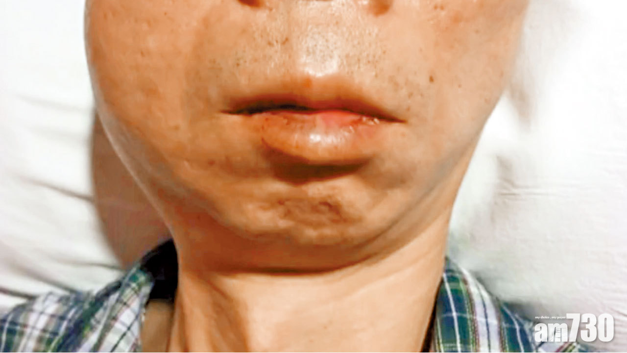 Now車長後腦疑中彈倒地 扣留警署2小時 稱遭毆打