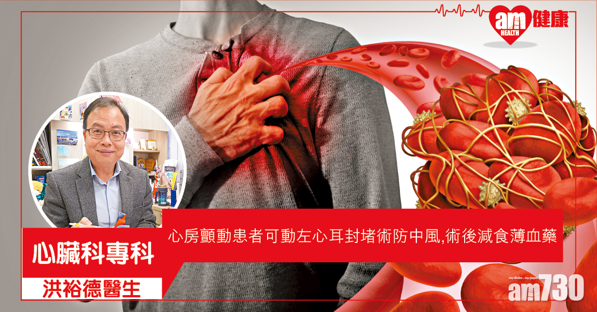 房顫患者 左心耳封堵術防中風