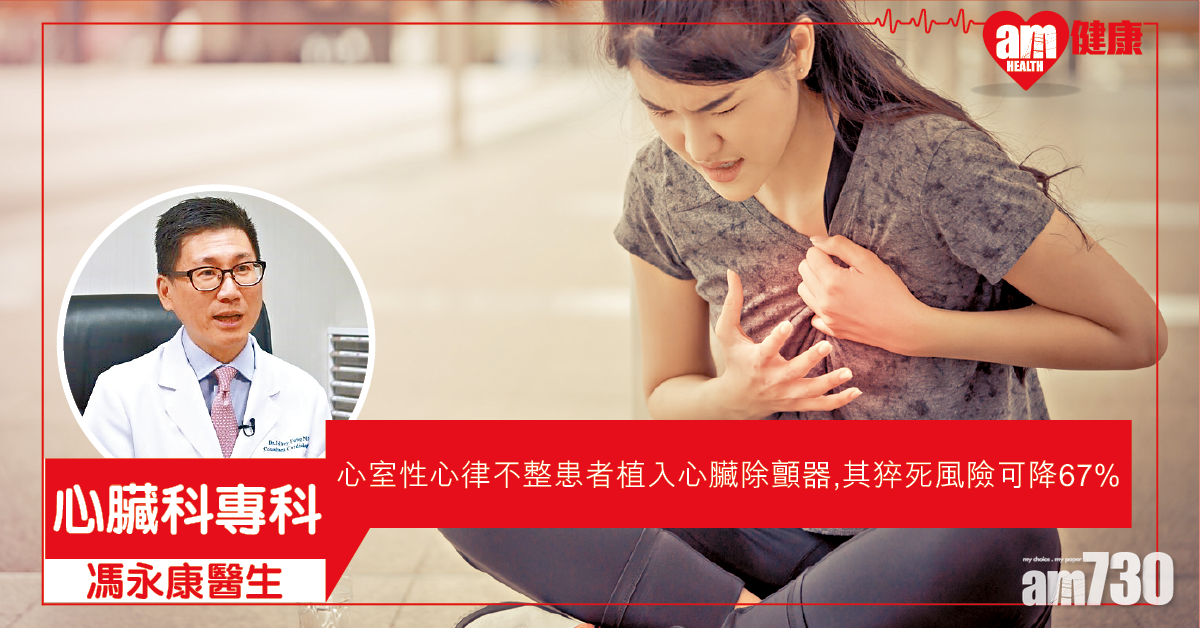 植入除顫器  防心臟猝死