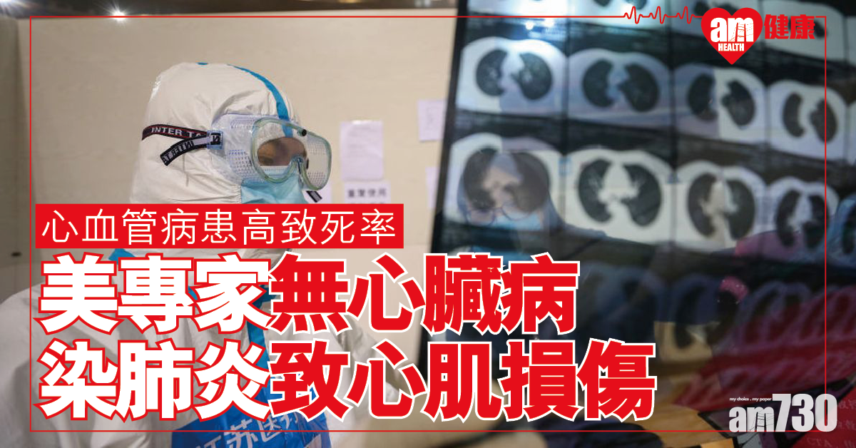 【新冠肺炎】美專家：心血管患者高致命率 就算無心臟病都中招