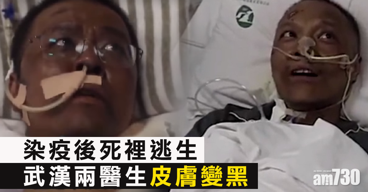 染疫兩月險死 武漢兩醫生變黑