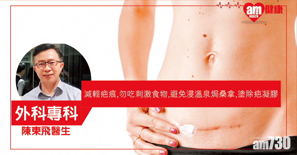 術後除疤 須醫患配合