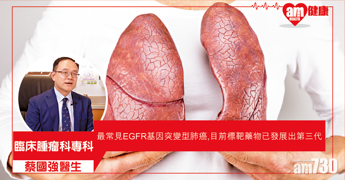 EGFR肺癌 及時用新一代標靶藥存活期更長
