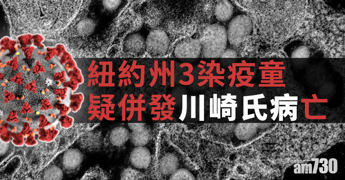 【新冠肺炎】紐約州3染疫童  疑併發「川崎氏病」亡  