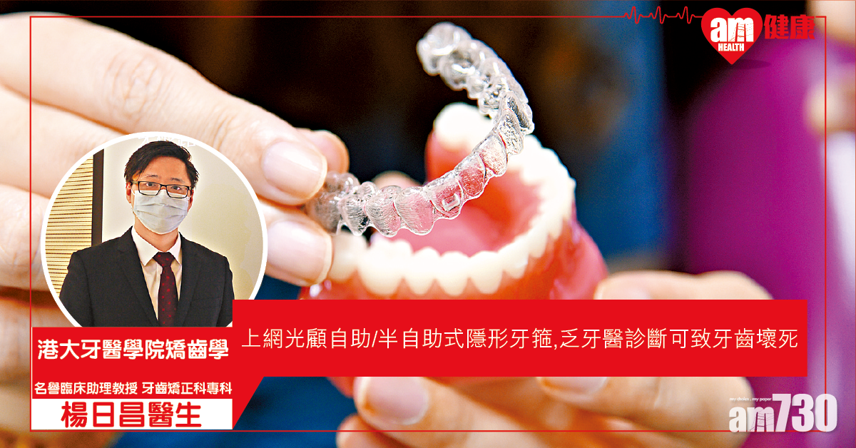 自助箍牙 小心牙齒壞死！