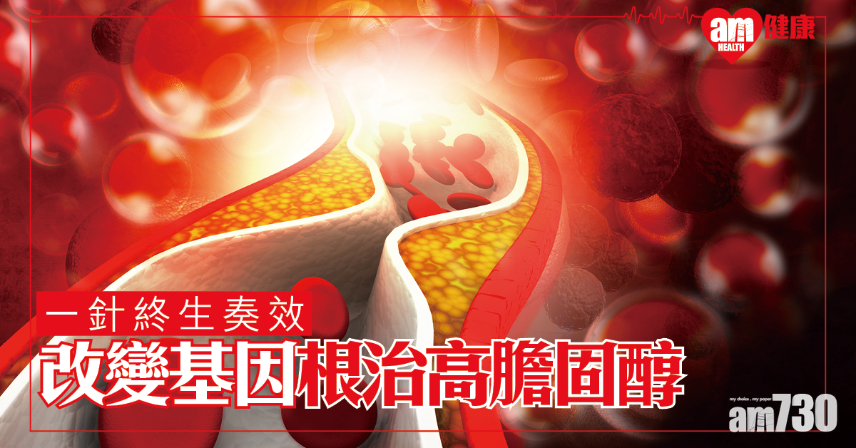 根治高膽固醇有希望