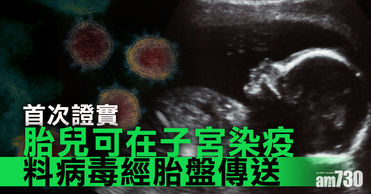 【新冠肺炎】首次證實胎兒可在子宮染疫  料病毒經胎盤傳送