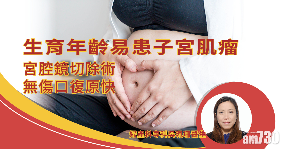 健康快訊：生育年齡易患子宮肌瘤 宮腔鏡切除術無傷口復原快