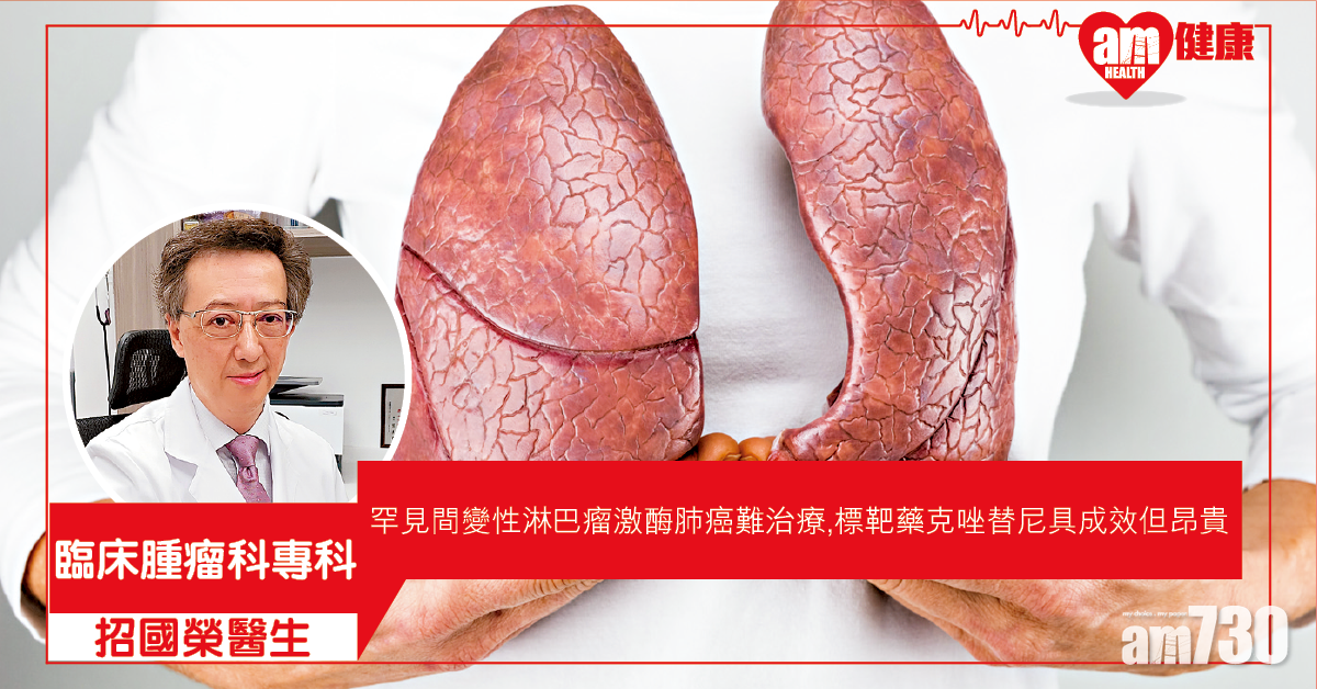 ALK肺癌年輕化 標靶藥資助減負擔