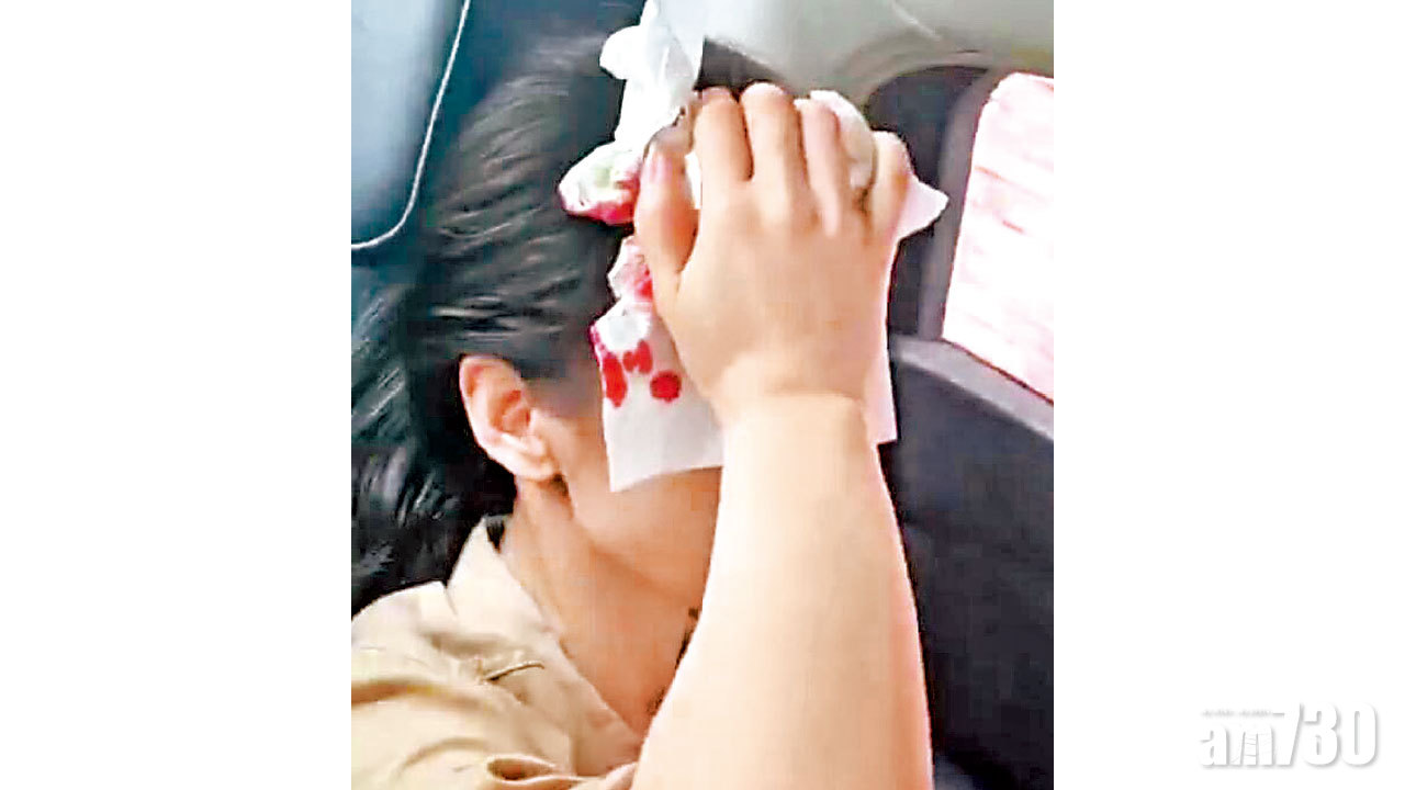 黃聖依拍戲扑穿頭