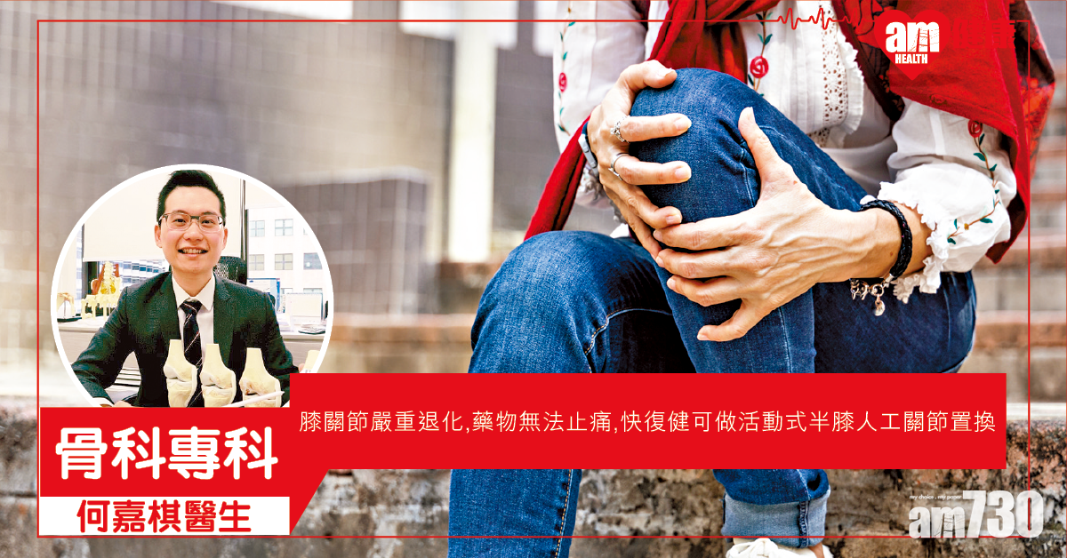 行樓梯卡卡聲 半膝關節置換延關節壽命