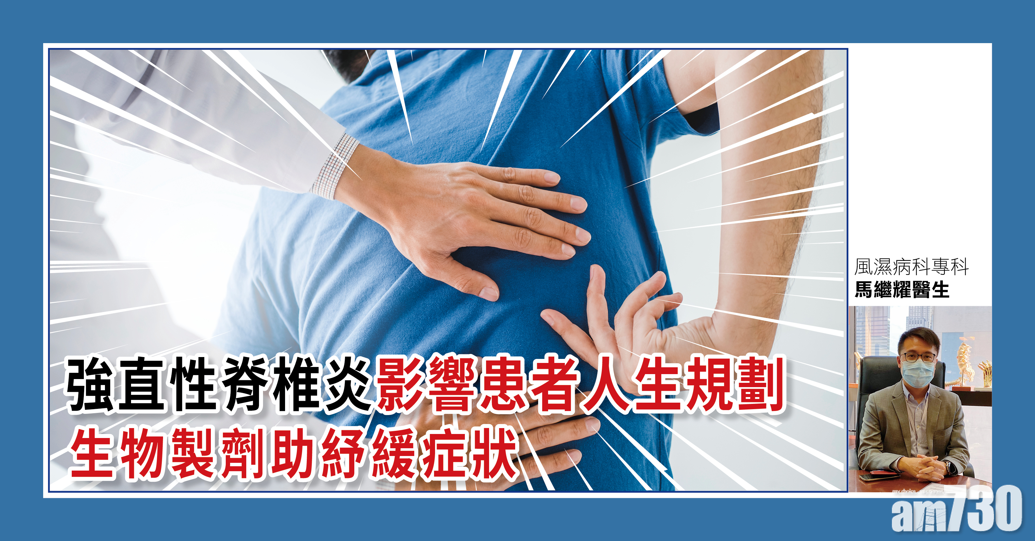 [健康快訊] 強直性脊椎炎影響患者人生規劃 生物製劑助紓緩症狀