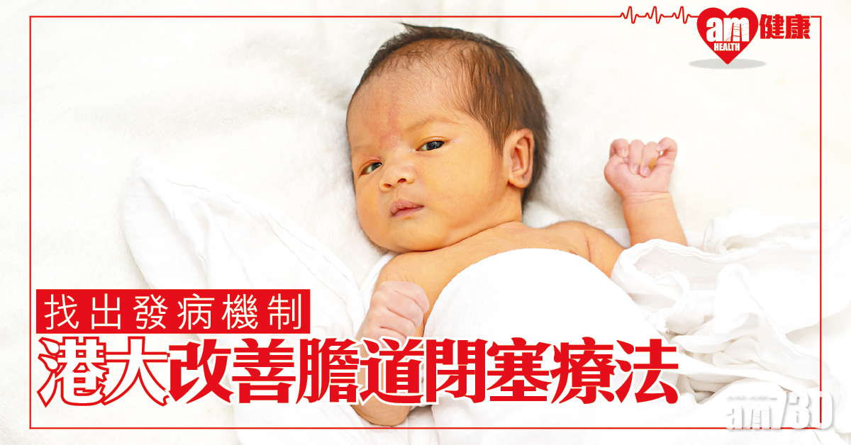 找出發病機制  改善膽道閉塞療效