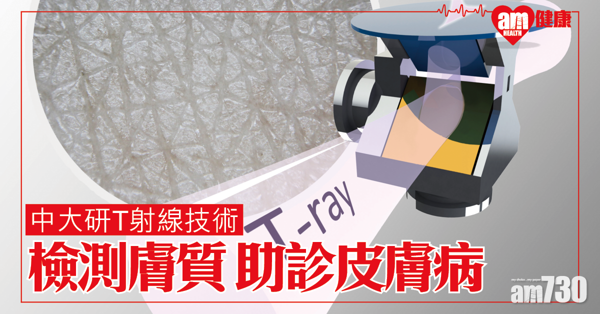 中大研發T射線技術 檢測膚質助診斷皮膚疾病