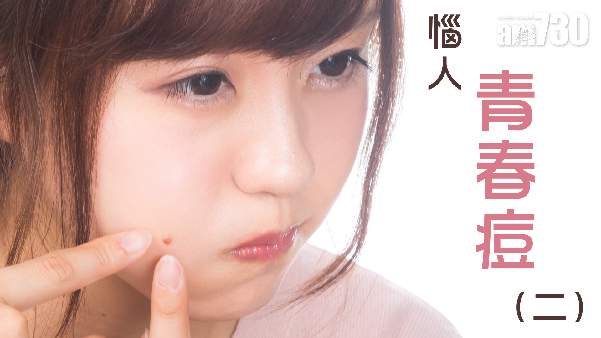 惱人青春痘(二)