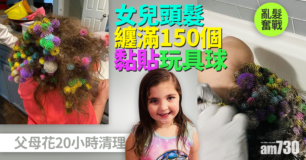家長噩夢｜女兒頭髮纏滿150個黏貼玩具球 父母花20小時清理