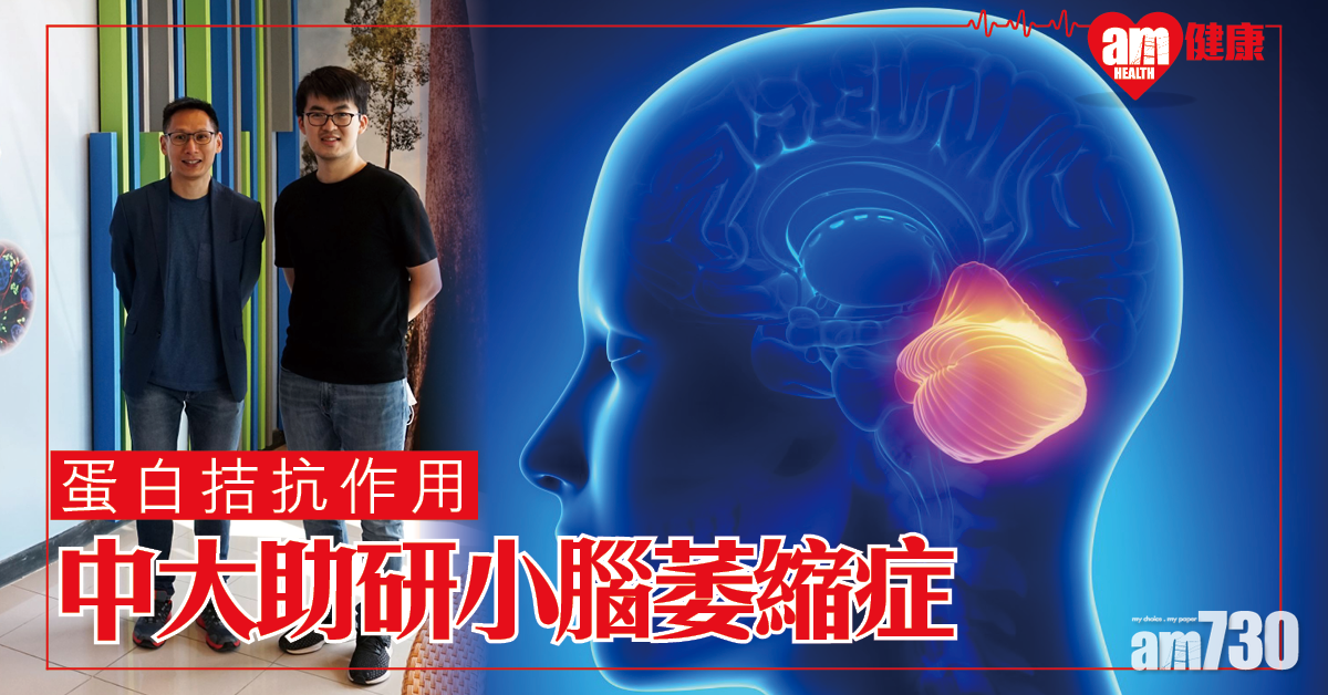中大揭蛋白間的拮抗作用 為干預小腦萎縮症三型治療提供新方向