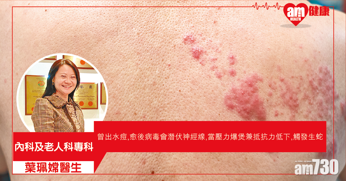 疫情壓力大 生蛇年輕化