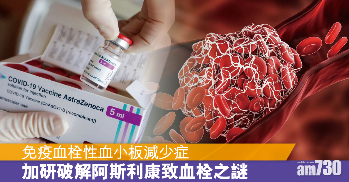 新冠疫苗丨阿斯利康疫苗引致血栓 類似肝素引起之血小板減少症