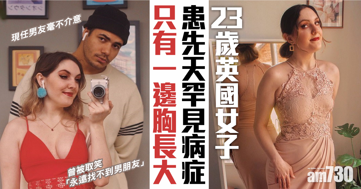 波蘭氏症候群｜23歲女患怪病  只有一邊胸長大