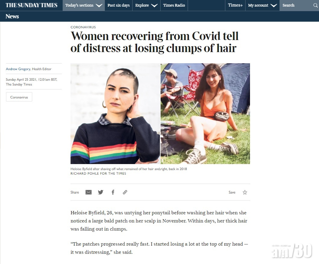 新冠肺炎｜英女患者康復後數月現「鬼剃頭」 專家：或與創傷後壓力有關