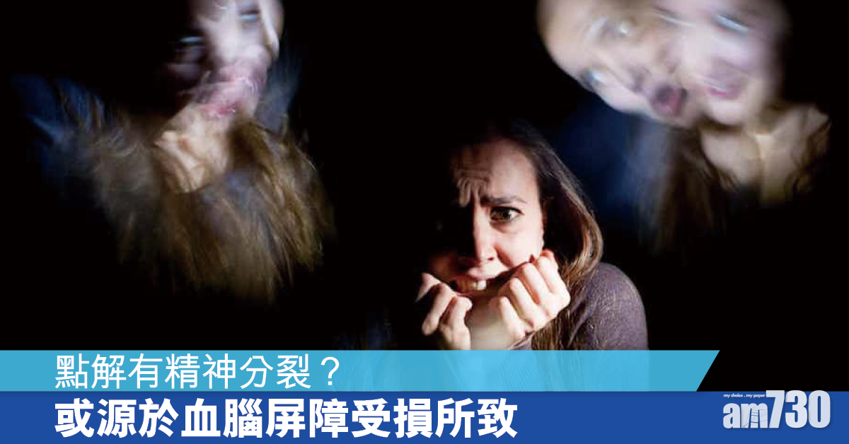 精神分裂症原因 研究：或源於血腦屏障受損