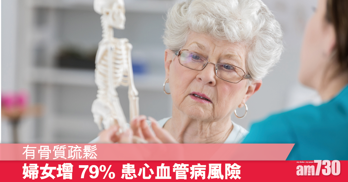 骨質疏鬆症女性患心血管病風險高79%