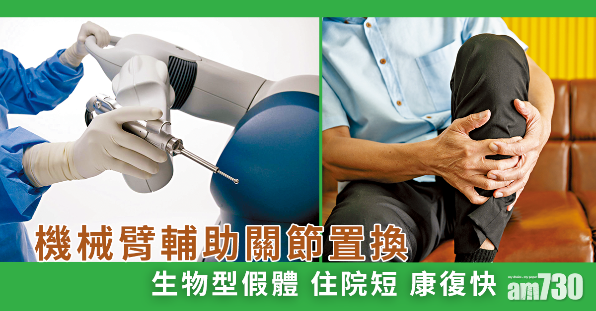 機械臂輔助關節置換 提升精確度更耐用