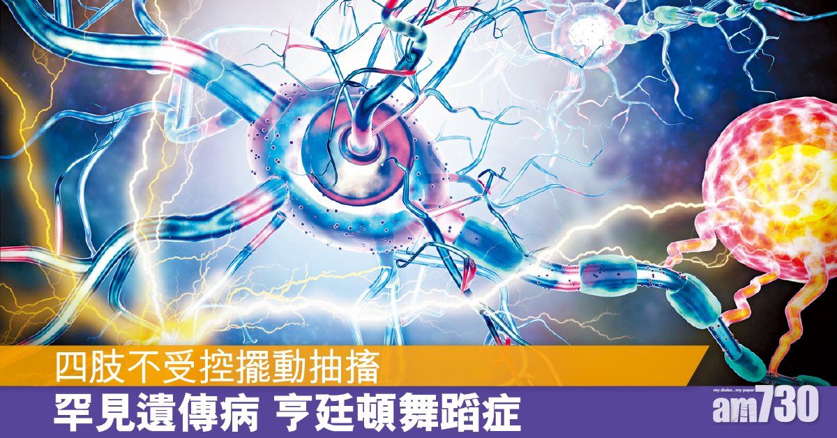 中大發現致病機制 亨廷頓舞蹈症治療現曙光