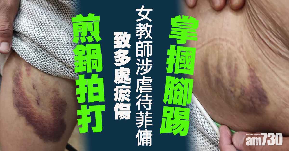 虐待外傭｜女教師涉虐待菲傭　掌摑腳踢煎鍋虐打多處瘀傷