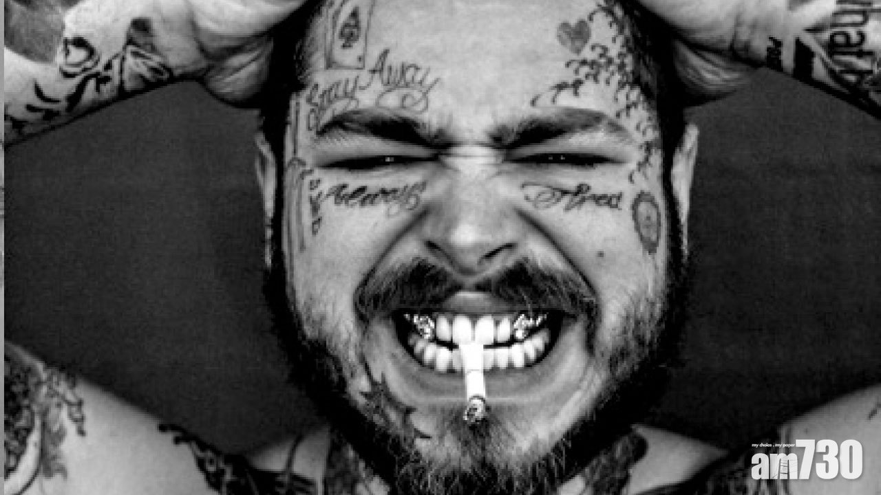 花千萬鑲鑽石假牙 Post Malone擁百萬微笑