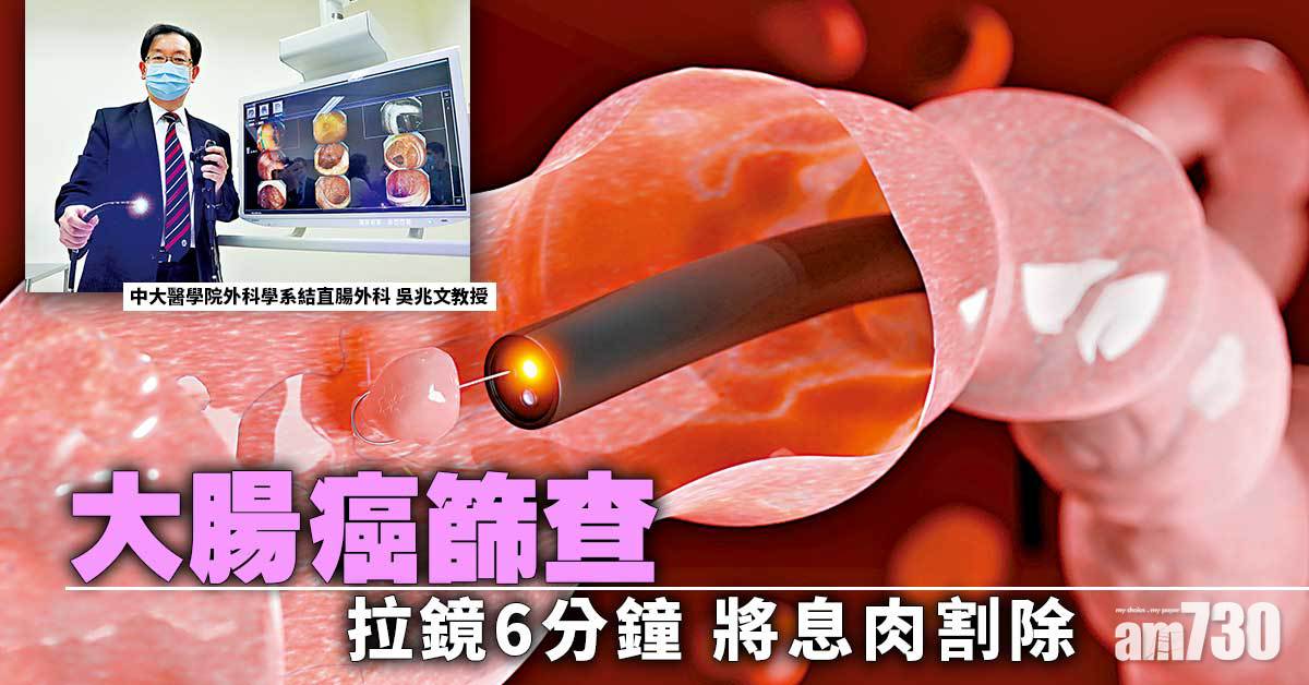 大腸癌篩查 早發現早處理