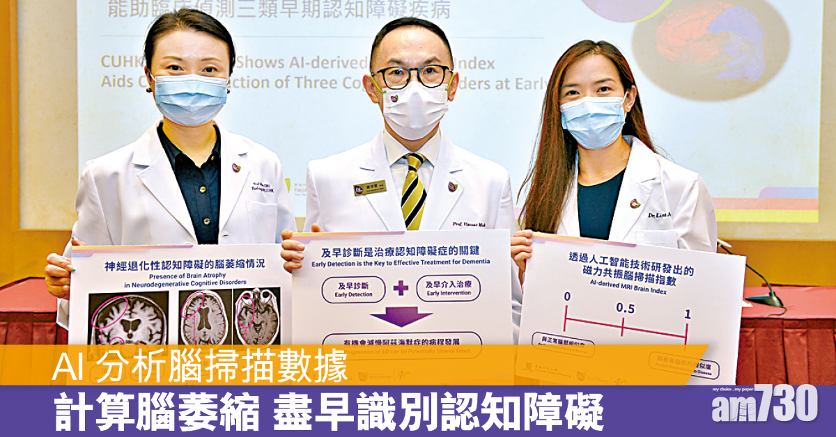 AI分析MRI影像 偵測早期認知障礙
