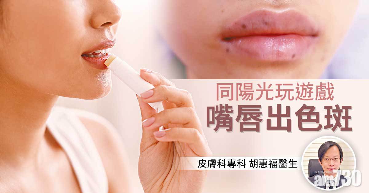 過度暴曬易出唇上黑斑