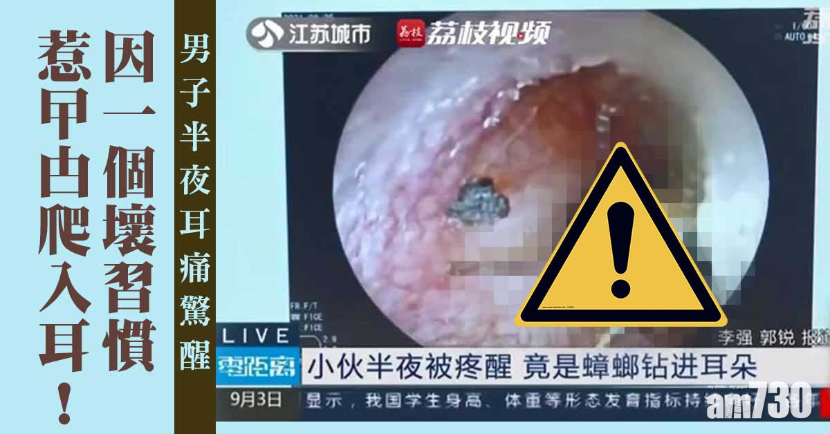 網上熱話｜半夜耳痛驚醒 男子一個壞習慣引曱甴爬入耳