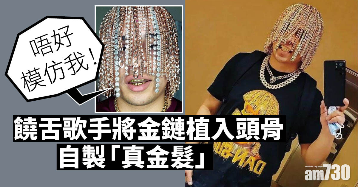 將金鏈植入頭骨自製「真金髮」  饒舌歌手警告：不要模仿我