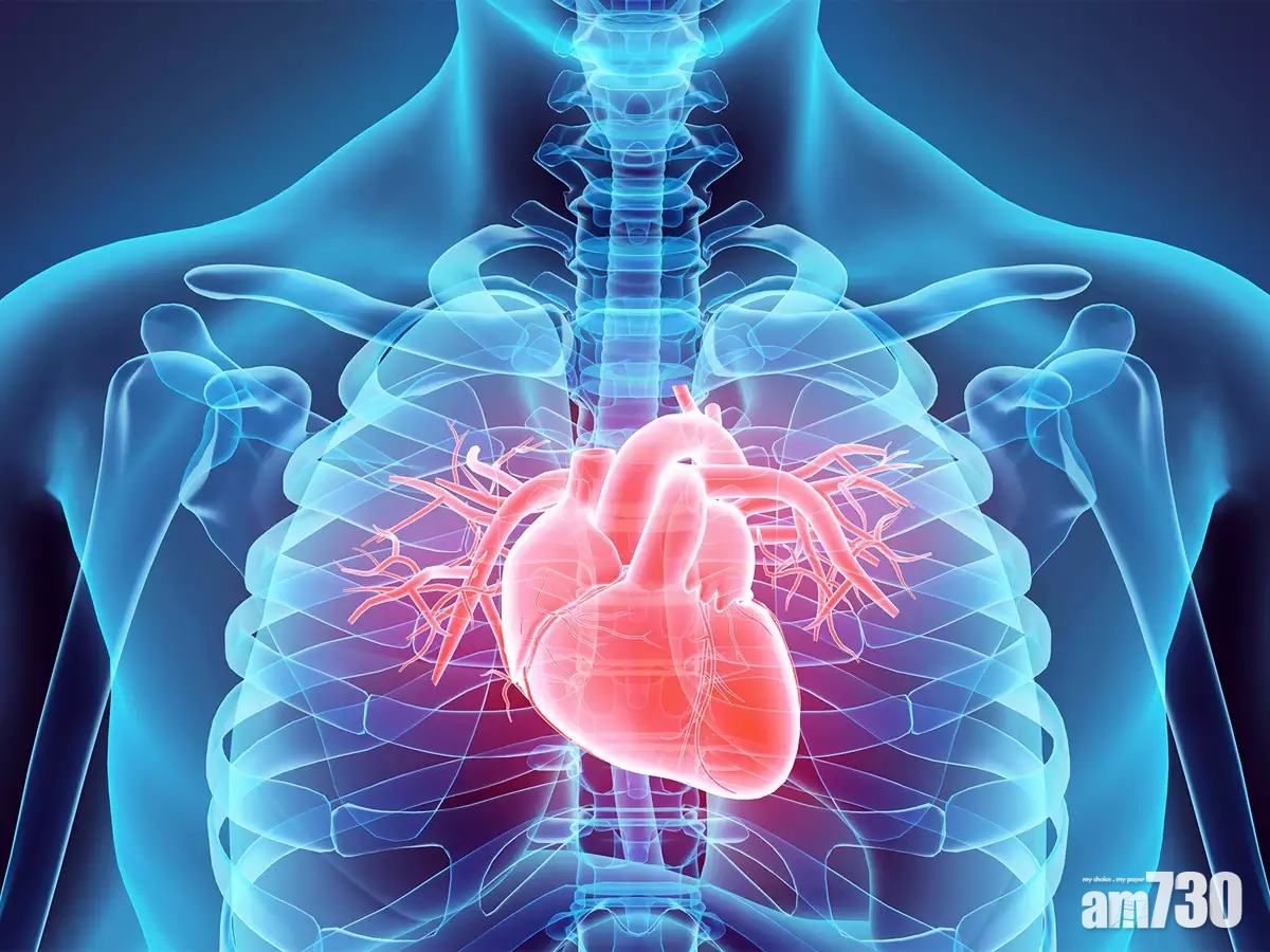 心臟移植｜心臟衰竭最後保命手段