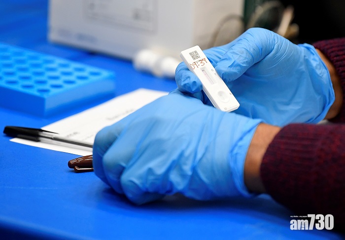 新冠肺炎︱逾4萬樣本結果疑出錯　英國檢測中心暫停化驗