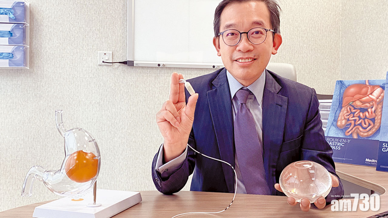 嚴重肥胖｜毋須麻醉 自然排出 新式吞服型胃水球降風險