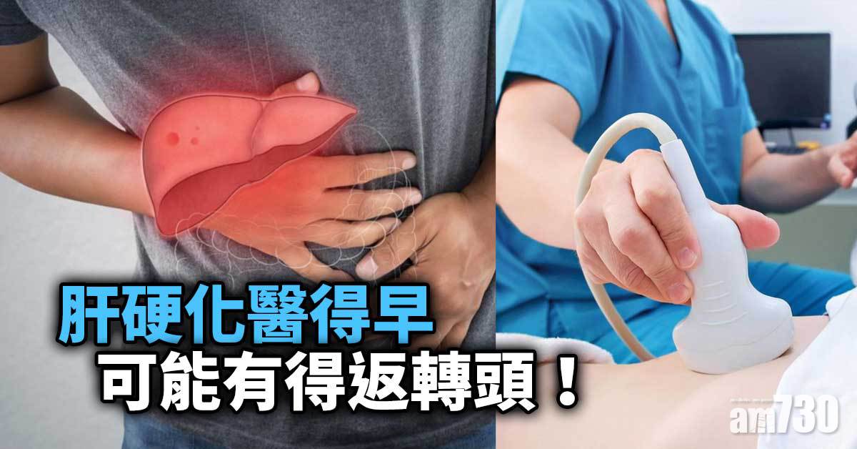 肝硬化｜醫得早 有耐性 可能有得返轉頭