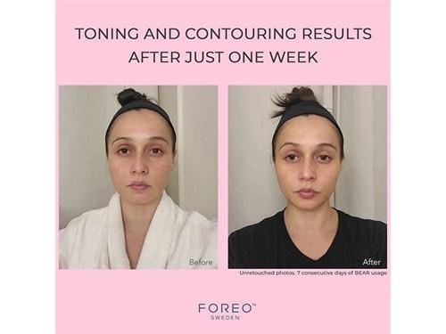 家用美容儀|Foreo BEAR