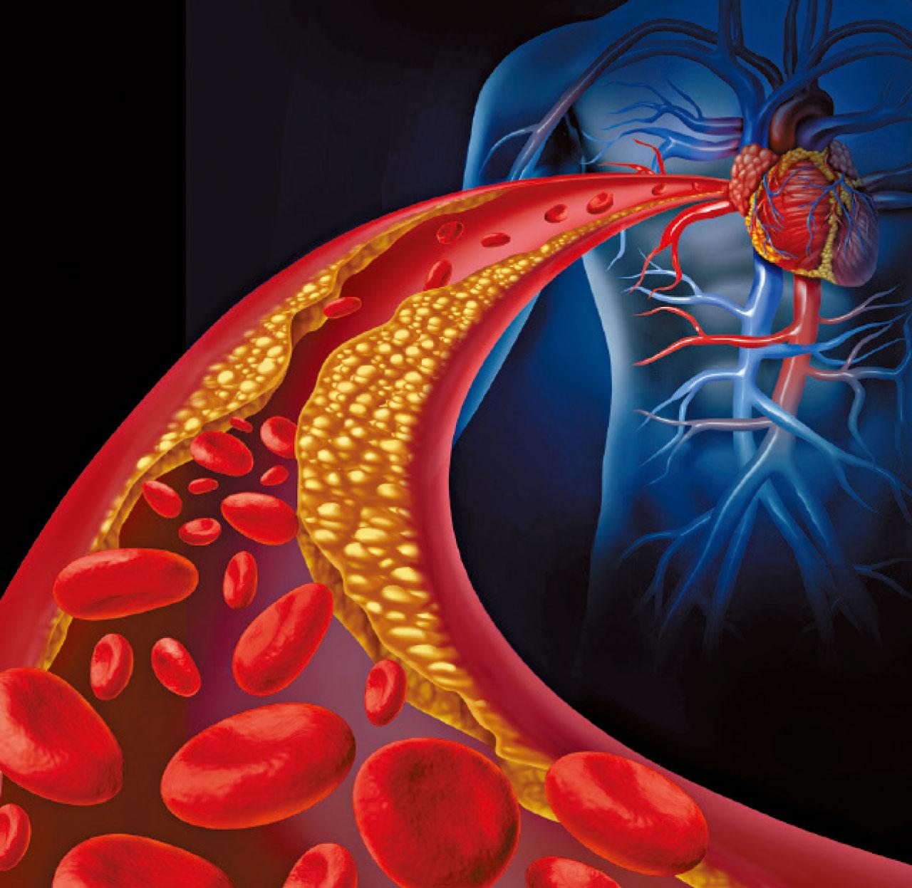急性胸痛評估 拆心臟病計時炸彈