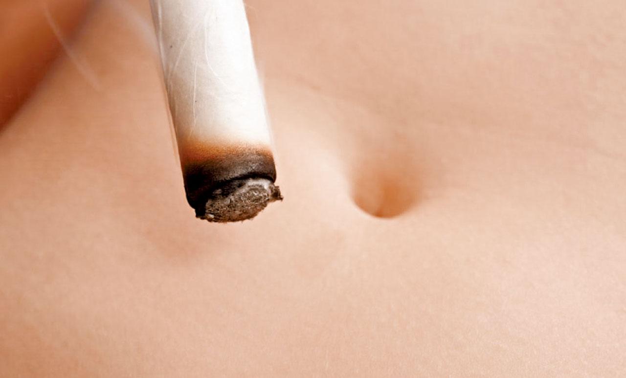 藿香正氣片 助染疫者排濕加快康復