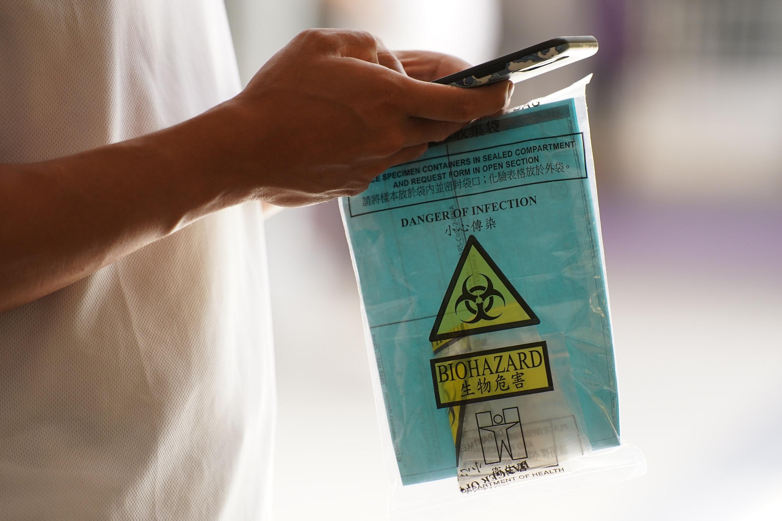 深喉唾液樣本。(資料圖片/陳奕釗攝)