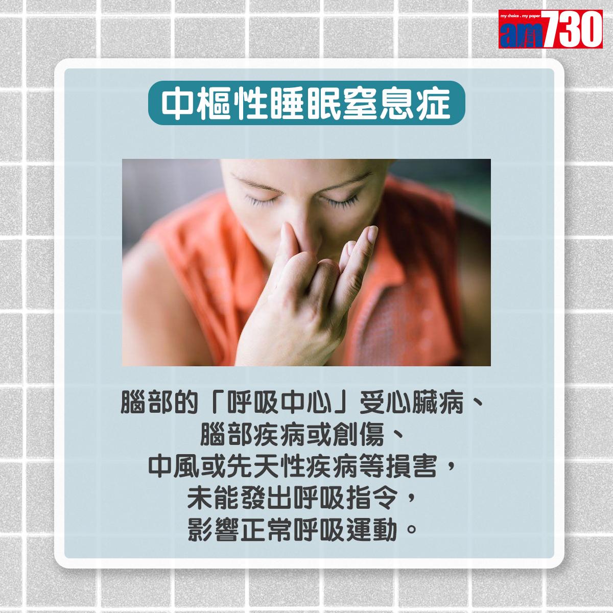 中樞性睡眠窒息症